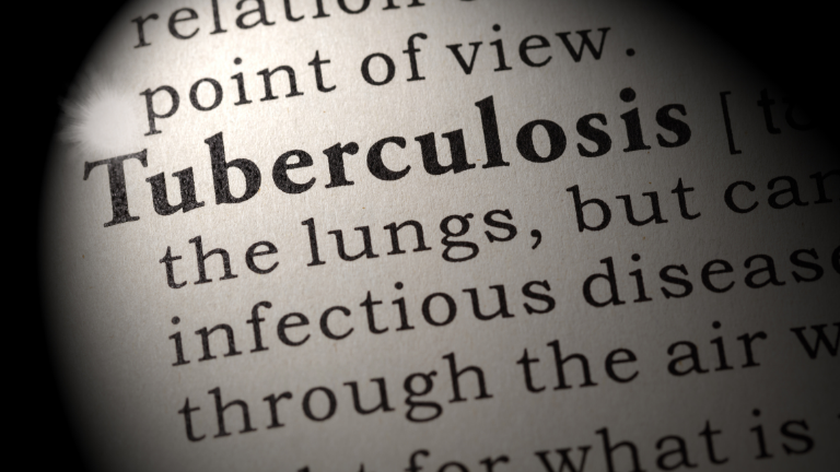 Sığırlarda Tüberküloz ve Paratüberküloz